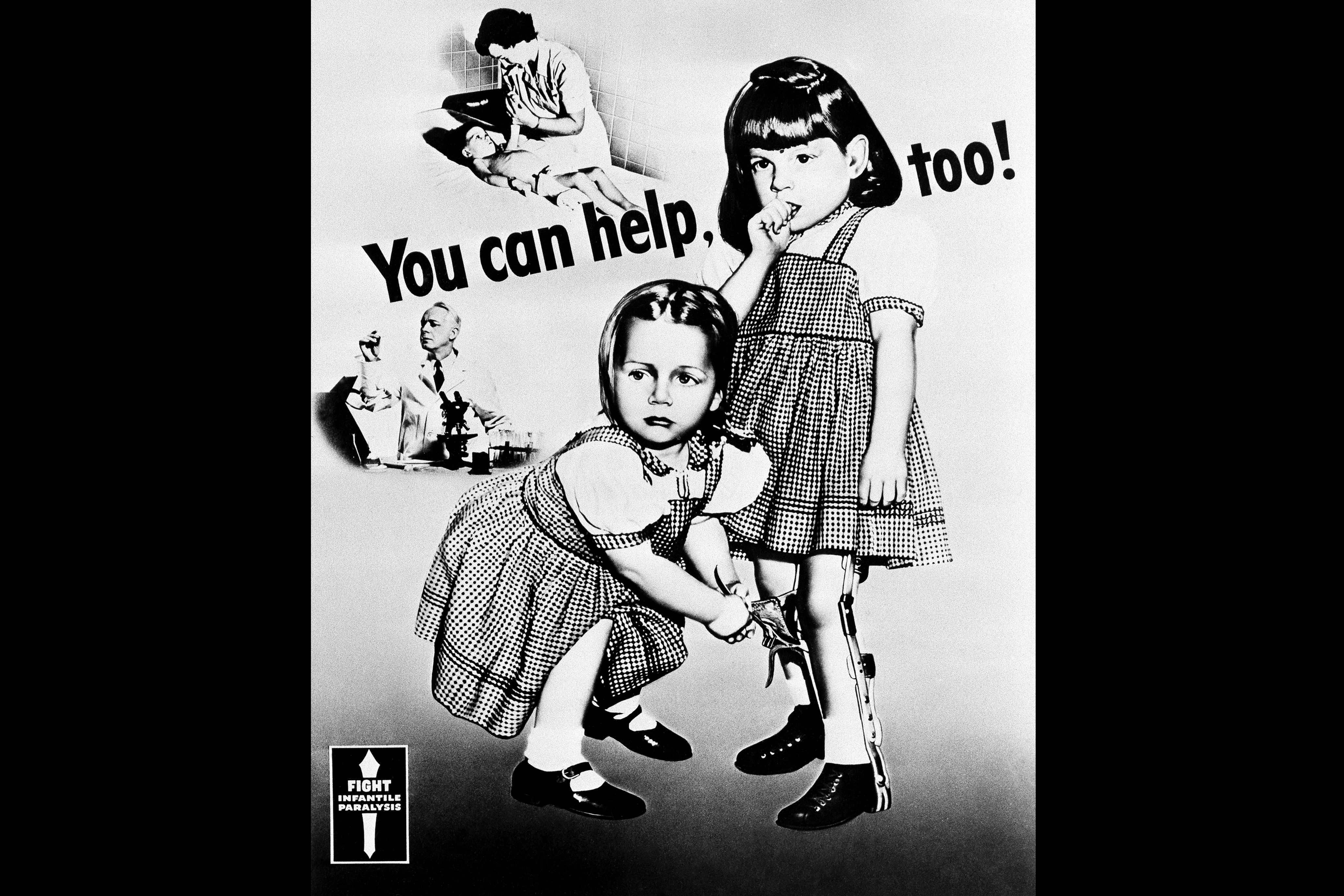 Patricia, 6, and Pamela, 5, were stricken with polio in 1948. They were poster children for the March of Dimes' campaign efforts to eradicate infantile paralysis. This poster first appeared in 1952. Patricia, 6, and Pamela, 5, were stricken with polio in 1948. They were poster children for the March of Dimes' campaign efforts to eradicate infantile paralysis. This poster first appeared in 1952.