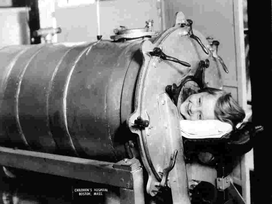 Many polio victims couldn't breathe on their own because of paralysis in their chest muscles. The iron lung — a simple, air-tight chamber that regulates air pressure — kept patients breathing until the paralysis passed. At the peak of the epidemic, rows of iron lung ventilators filled hospital rooms.
