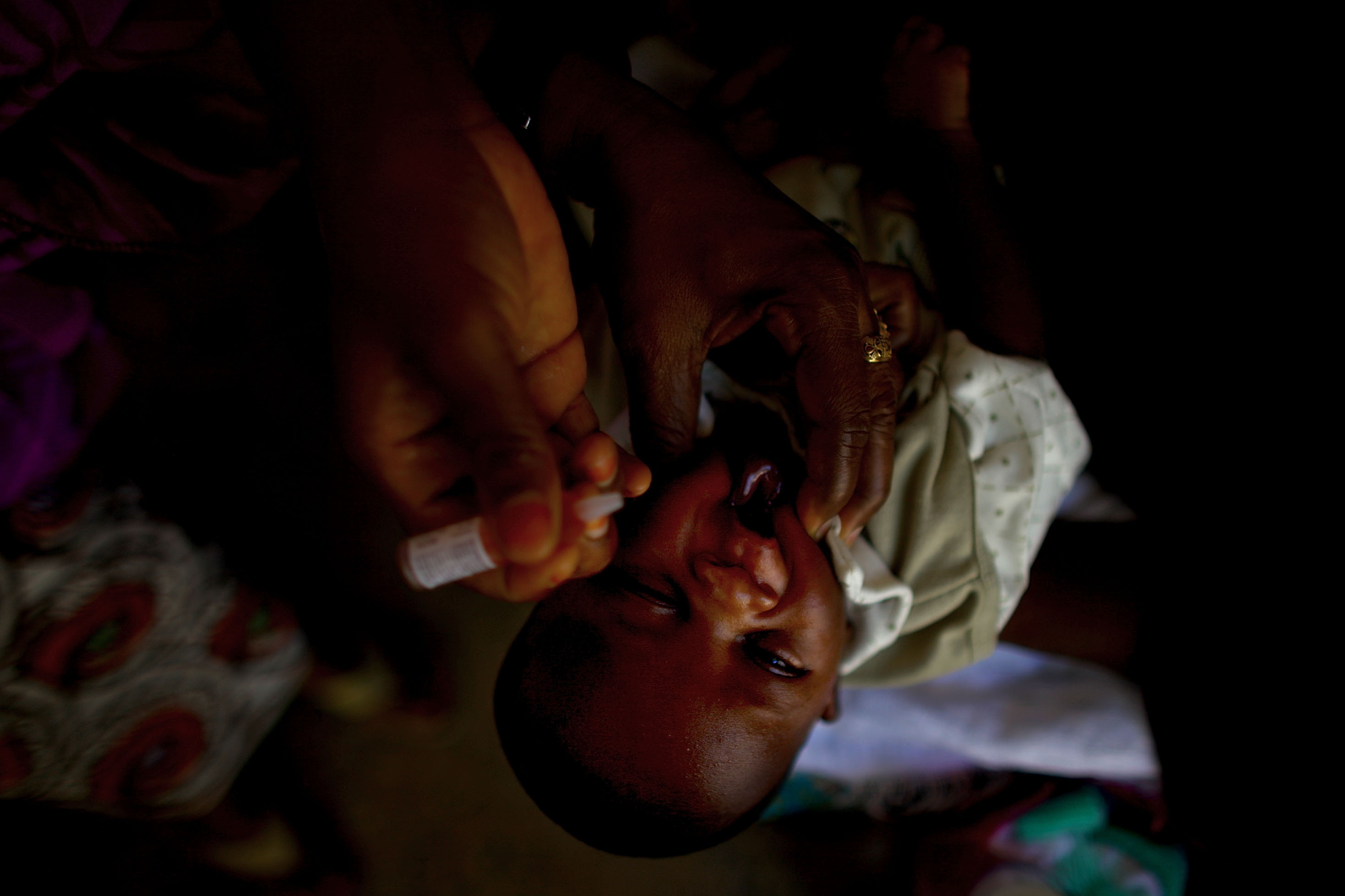 A child is vaccinated against polio at the Minjibir health clinic. The procedure, in which two drops of vaccine are pinched into a child's mouth, only takes a few seconds. Children should get at least three doses of the vaccine, spread out over time.
