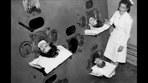 During the peak of the polio epidemic in the U.S., some hospital wards even had large, room-like iron lungs where multiple children lived.