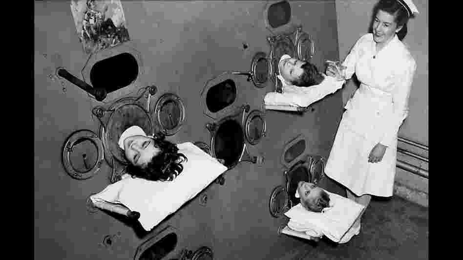 During the peak of the polio epidemic in the U.S., some hospital wards even had large, room-like iron lungs where multiple children lived.
