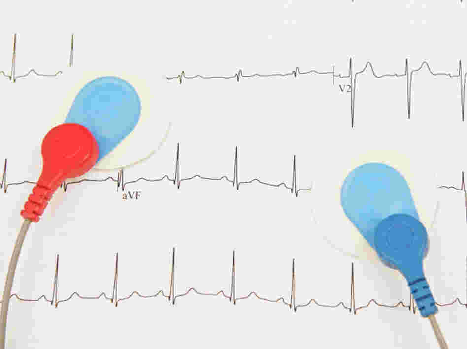 electrodes
