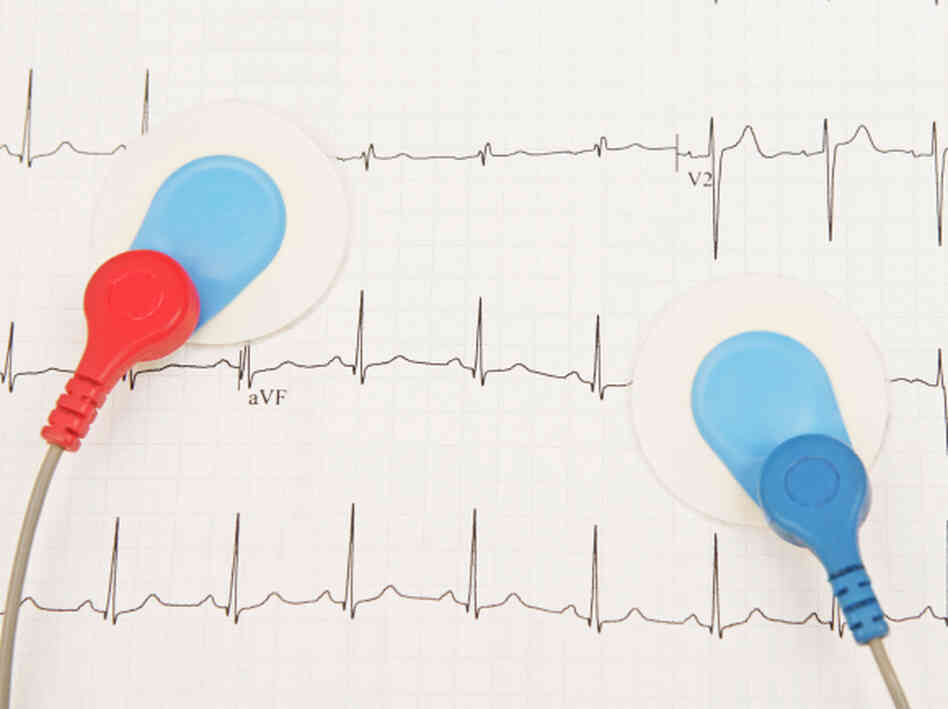 electrodes