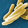 Under the microscope, Mycobacterium tuberculosis bacteria. The germs that cause TB have become resistant to many drugs. Under the microscope, Mycobacterium tuberculosis bacteria. The germs that cause TB have become resistant to many drugs.