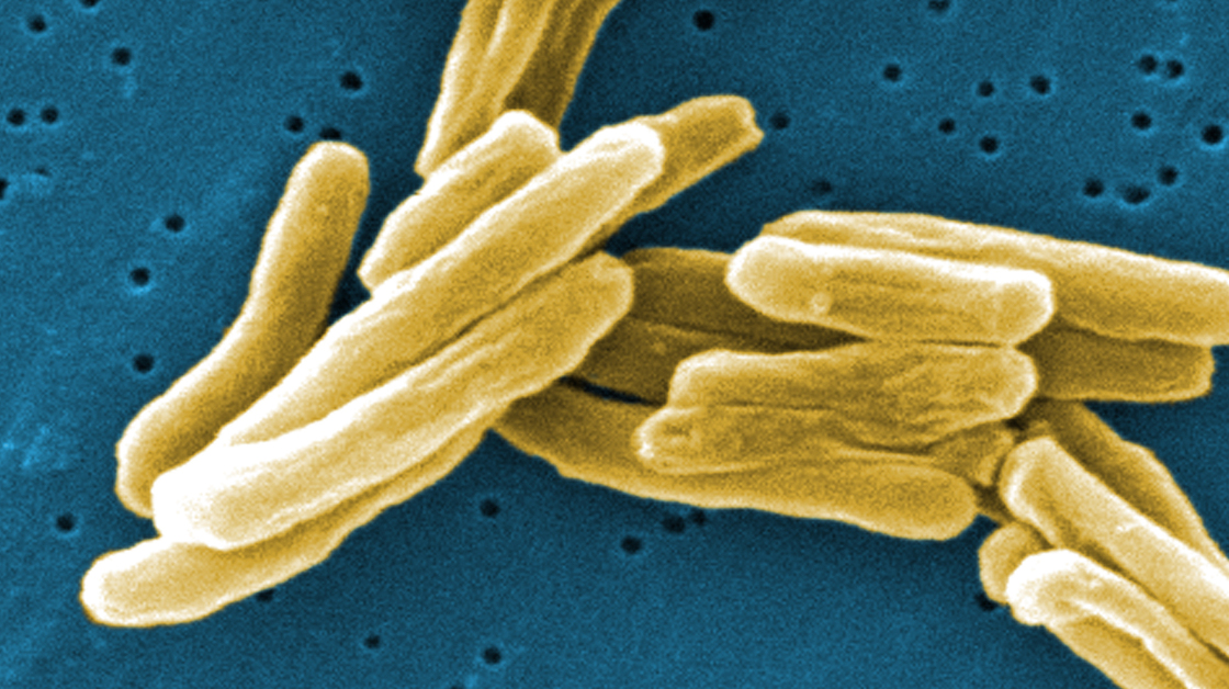 Under the microscope, Mycobacterium tuberculosis bacteria. The germs that cause TB have become resistant to many drugs.
