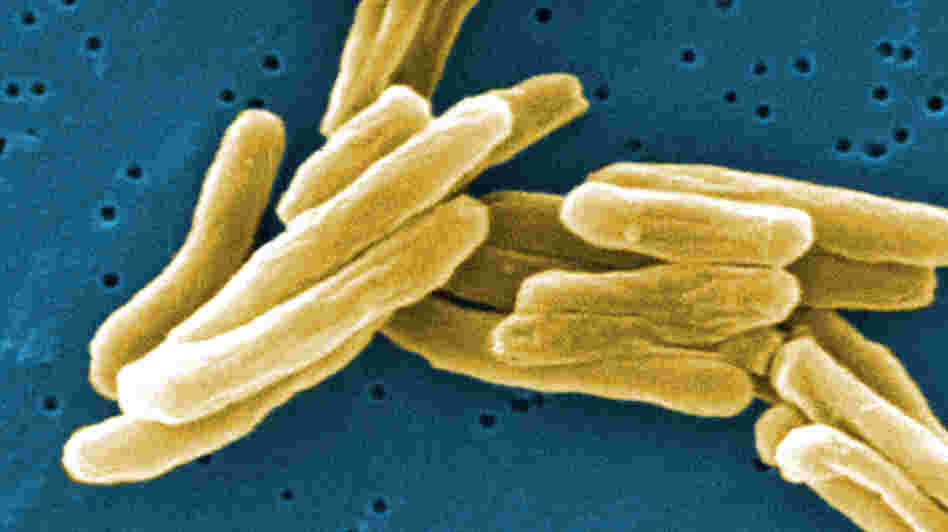 Under the microscope, Mycobacterium tuberculosis bacteria. The germs that cause TB have become resistant to many drugs.