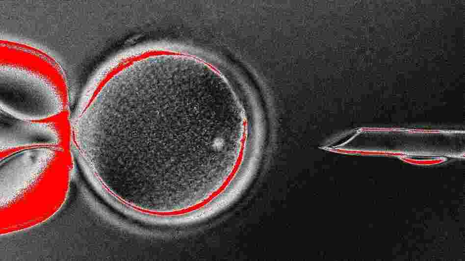 An image of researchers at Oregon Health & Science University removing the nucleus from the mother's cell before it's inserted into the donor's egg cell.