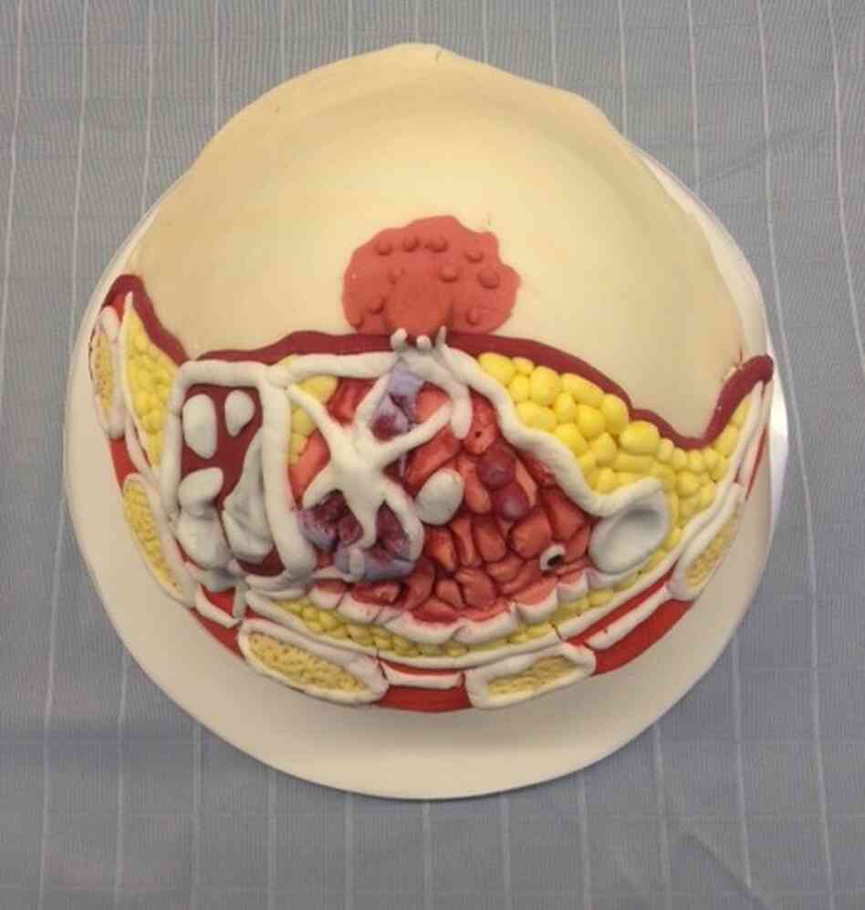 What a boob: A cupcake by cakemaker "Miss Insomnia Tulip" draws inspiration from breast diagrams in educational pathology.