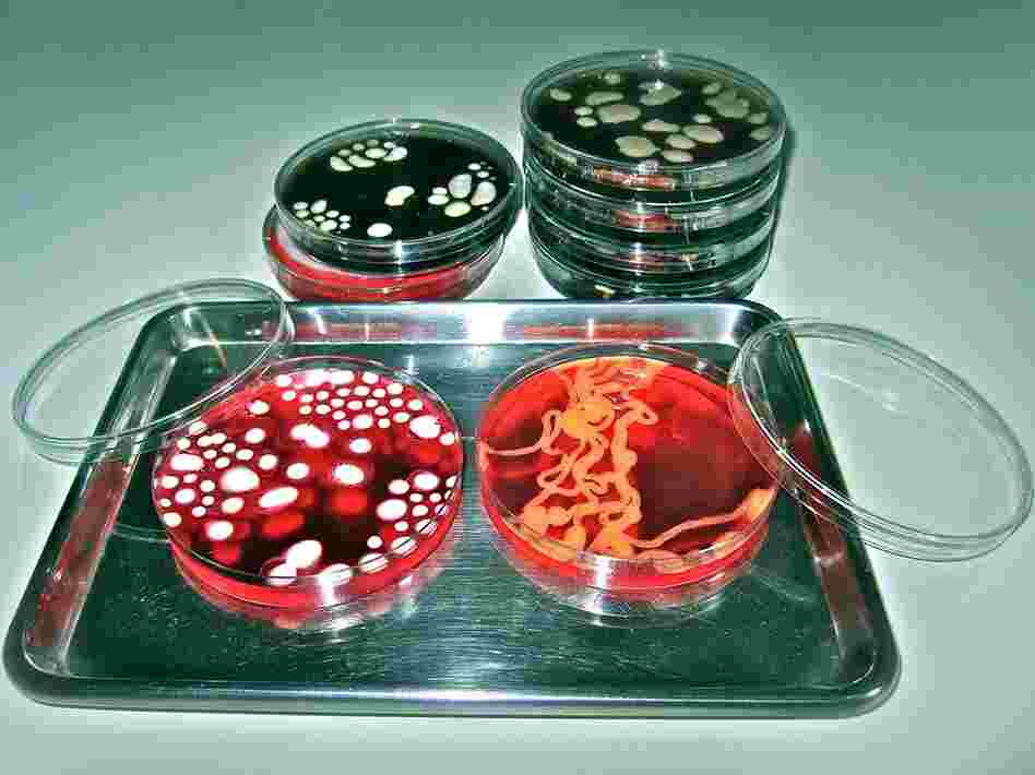 Bacterial 'Jelly' with a Kick: Jello cocktails depicting bacterial sample smears in laboratory petri dishes from the Conjurer's Kitchen.