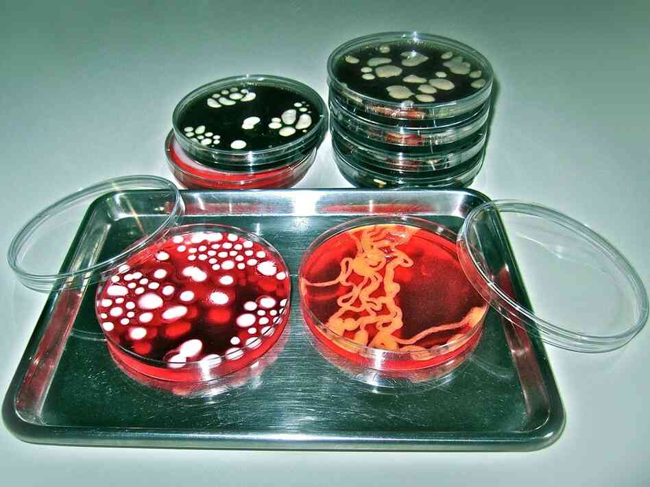 Bacterial 'Jelly' with a Kick: Jello cocktails depicting bacterial sample smears in laboratory petri dishes from the Conjurer's Kitchen.