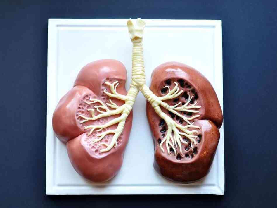 Lung Cancer Warning: A cake by Sarah Hardy Cakes in London juxtaposes a healthy lung with that of a smoker.