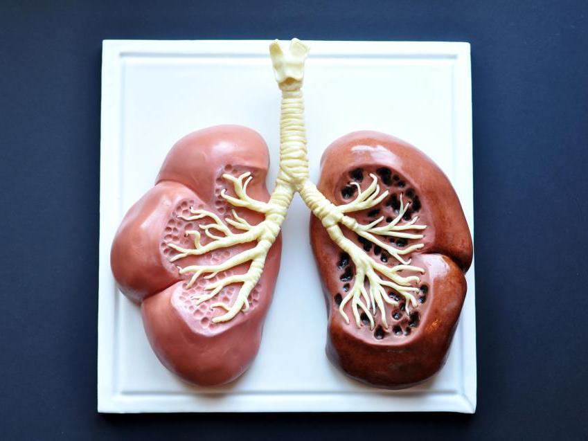 Lung Cancer Warning: A cake by <a href=