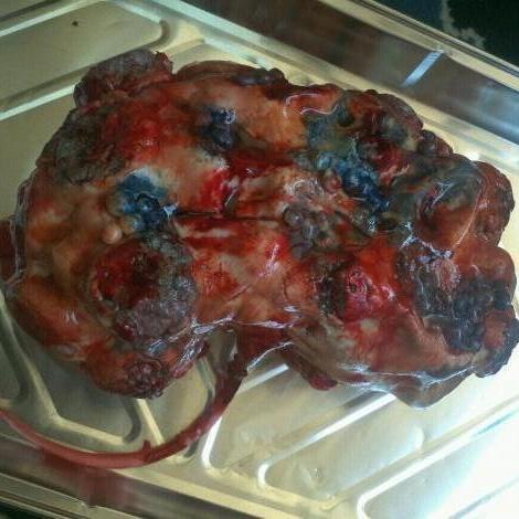Kidney Cake: Cakes by Victoria baked this marshmallow red velvet cake to look like a post mortem, polycystic kidney.