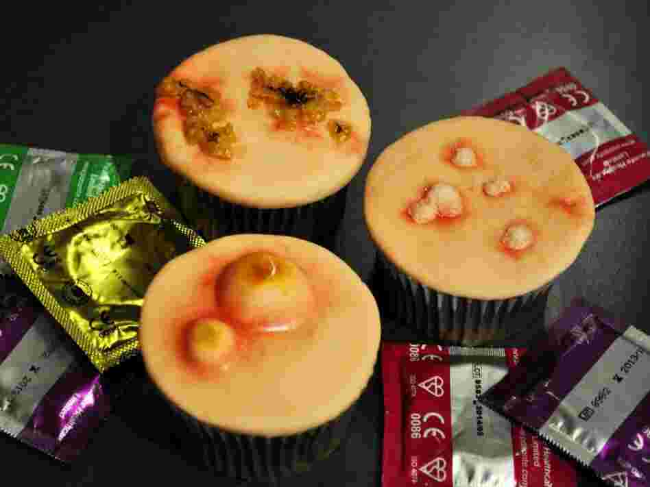 STD cupcakes: From Two Little Cats Bakery in Cambridge & Hertfordshire, these chocolate cupcakes feature symptoms of sexually transmitted diseases, including gonorrhea, syphilis, genital warts, chlamydia and HIV.