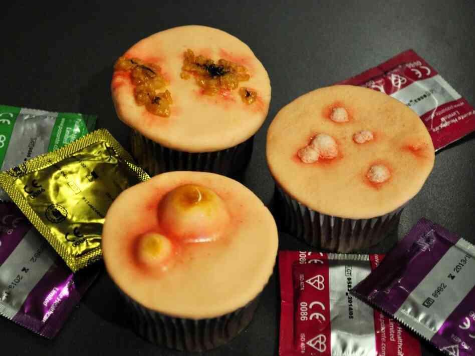 STD cupcakes: From Two Little Cats Bakery in Cambridge & Hertfordshire, these chocolate cupcakes feature symptoms of sexually transmitted diseases, including gonorrhea, syphilis, genital warts, chlamydia and HIV.