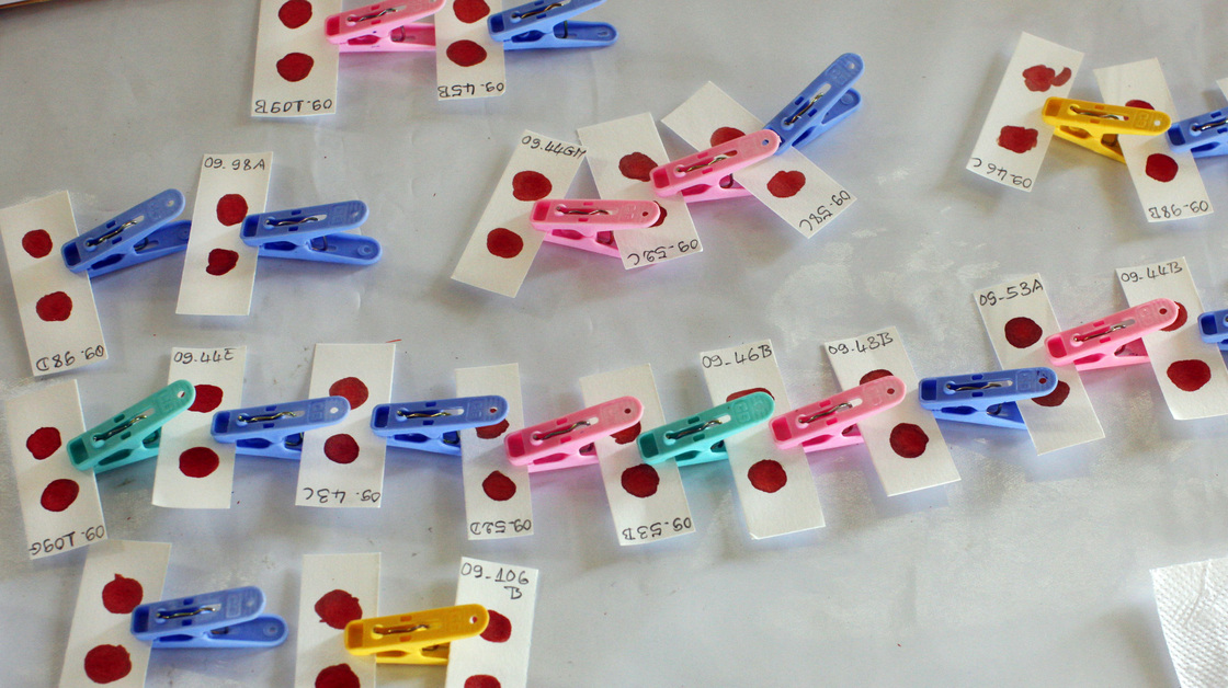 Blood samples dry during malaria screening. Public health workers call for more malaria testing in Africa to stop costly drugs from being handed out to kids with pneumonia.