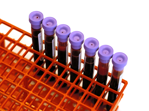 Before filling one of these tubes with blood for a cholesterol test, you're supposed to keep your stomach empty. But that may not be necessary.
