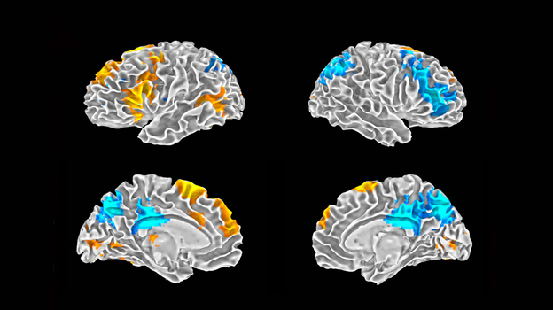 The warmer orange colors show parts of the brain most active during improvisational rap. The blue regions are most active when rappers performed a memorized piece.