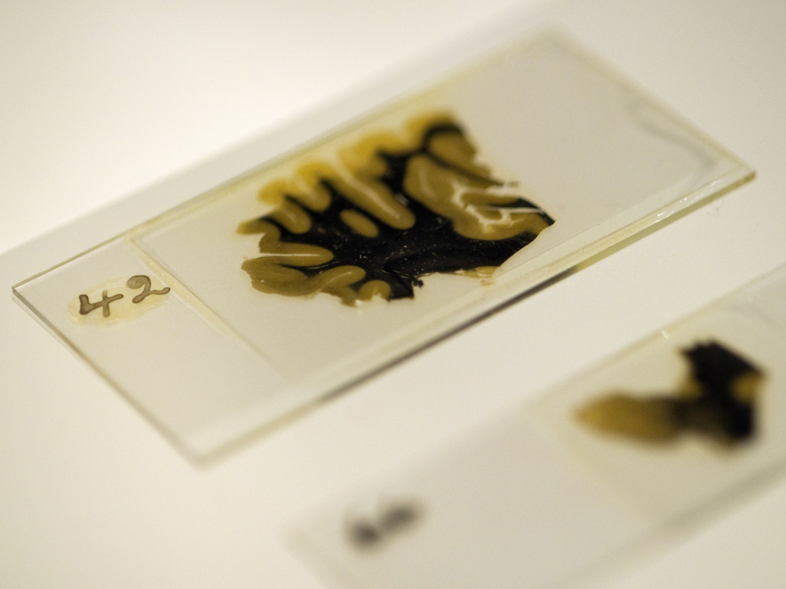 Thin slices of Einstein's brain were preserved on slides prepared by lab technician Marthe Keller in 1955.