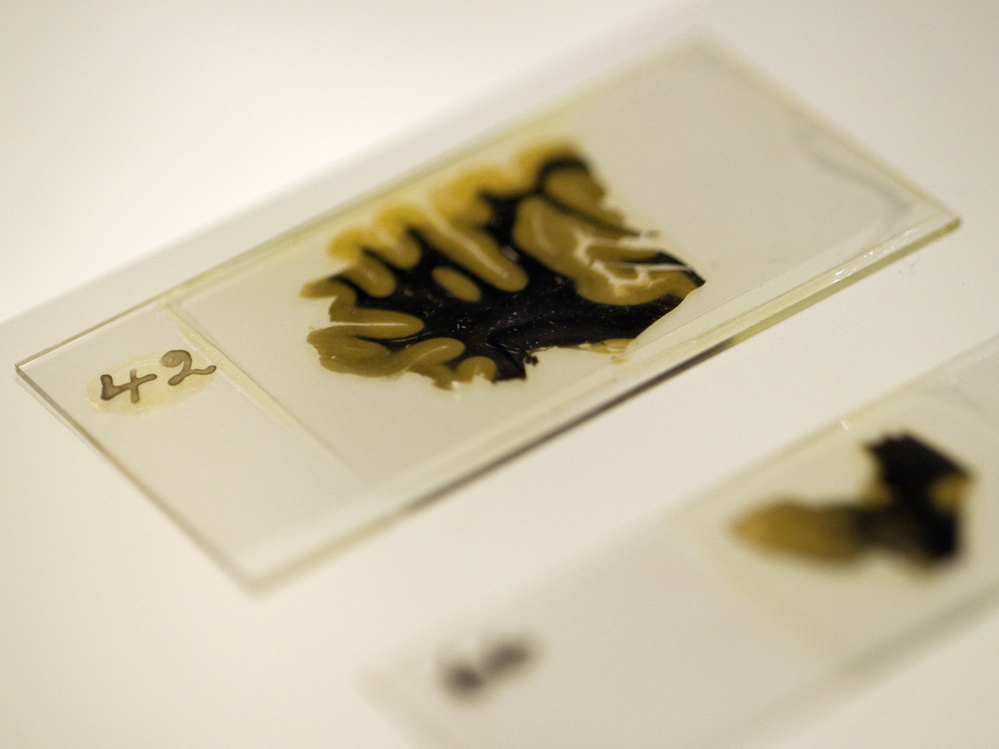 Thin slices of Einstein's brain were preserved on slides prepared by lab technician Marthe Keller in 1955.
