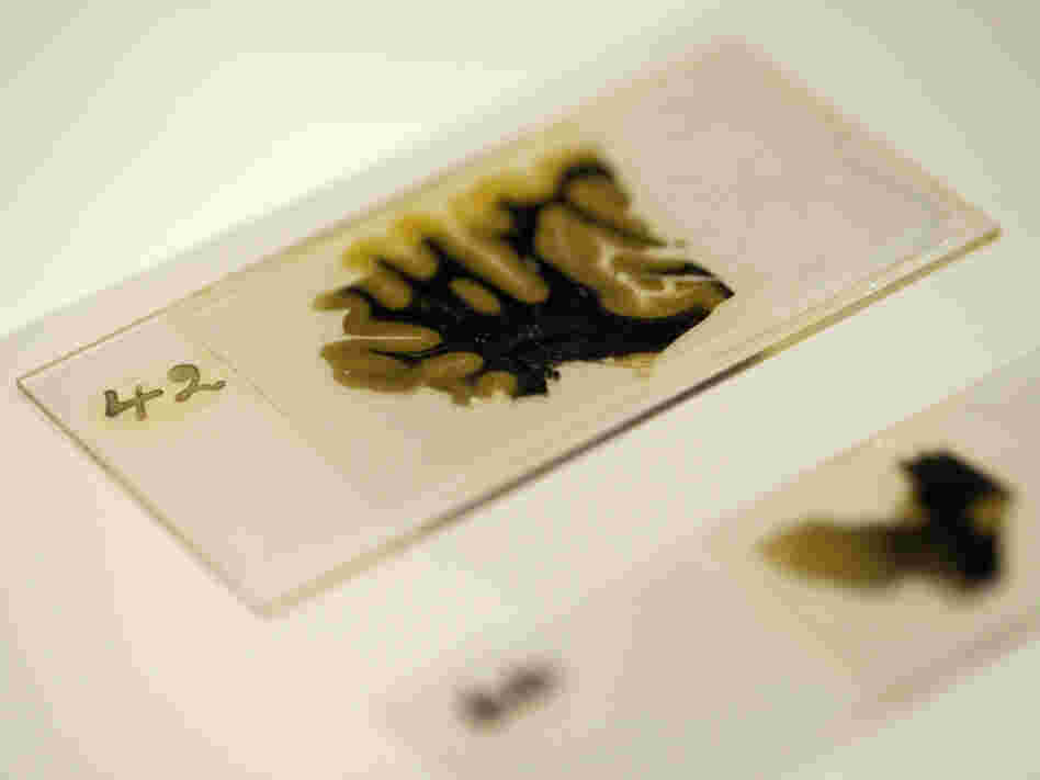 Thin slices of Einstein's brain were preserved on slides prepared by lab technician Marthe Keller in 1955.