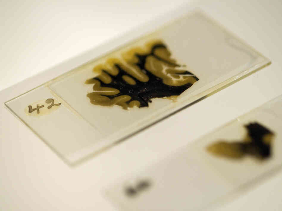 Thin slices of Einstein's brain were preserved on slides prepared by lab technician Marthe Keller in 1955.