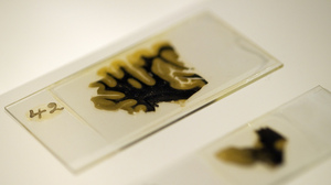 Thin slices of Einstein's brain were preserved on slides prepared by lab technician Marthe Keller in 1955.