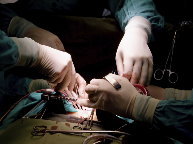Researchers find that more than 40 percent of surgical complications happen after patients leave the hospital.