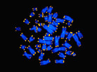 A light micrograph image of telomeres, shown in yellow, at the end of human chromosomes. Women tend to have longer telomeres than men and tend to outlive men, according to new research matching genetic information with medical records. A light micrograph image of telomeres, shown in yellow, at the end of human chromosomes. Women tend to have longer telomeres than men and tend to outlive men, according to new research matching genetic information with medical records.