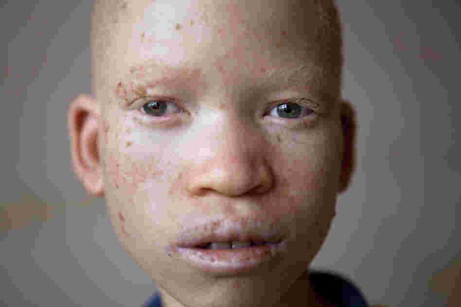 Eumen, 13, hasn't seen his mother in the four years he has lived at the center. "I wish to go home, even for one day," he says. "One day would be enough for me." His mother protected him from attack by a group of men and lost the use of her arm from an injury she suffered in the attack.