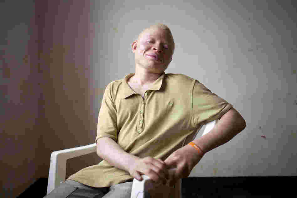 Gilbert Andrews, 15, wants to become a lawyer to help protect the rights of people with albinism. "Some educated people know we are real people, but others call us bad names," he says. "We faced the public with being discriminated against in class. Teachers put us in the back and said that people with albinism cannot be educated."
