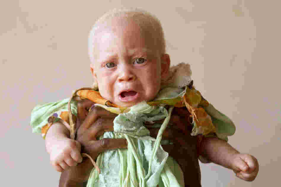 Abdulswamad, 7 months, was brought to the center by his mother, who was afraid they would be attacked.