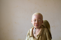 Musa, age unknown, was abandoned at the center. He is believed to be from the region bordering Burundi, where a black market in body parts of albinos is thriving.