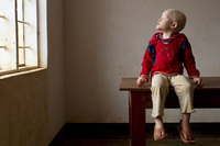 Yonge, 4, was abandoned by her parents at the Kabanga Protectorate Center. A local reverend hopes to adopt her but has not been able to take her home because of bureaucratic delays.