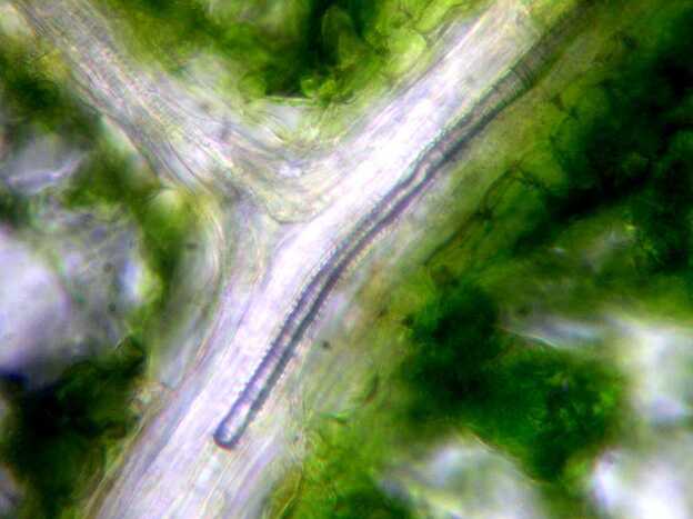An air embolism in a narrow water-transporting cell in a leaf of a walnut tree, captured using light microscopy. Drought stress increases the likelihood of embolism, reduces photosynthesis and may eventually lead to plant death.