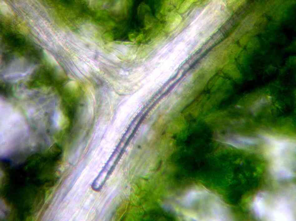An air embolism in a narrow water-transporting cell in a leaf of a walnut tree, captured using light microscopy. Drought stress increases the likelihood of embolism, reduces photosynthesis and may eventually lead to plant death.