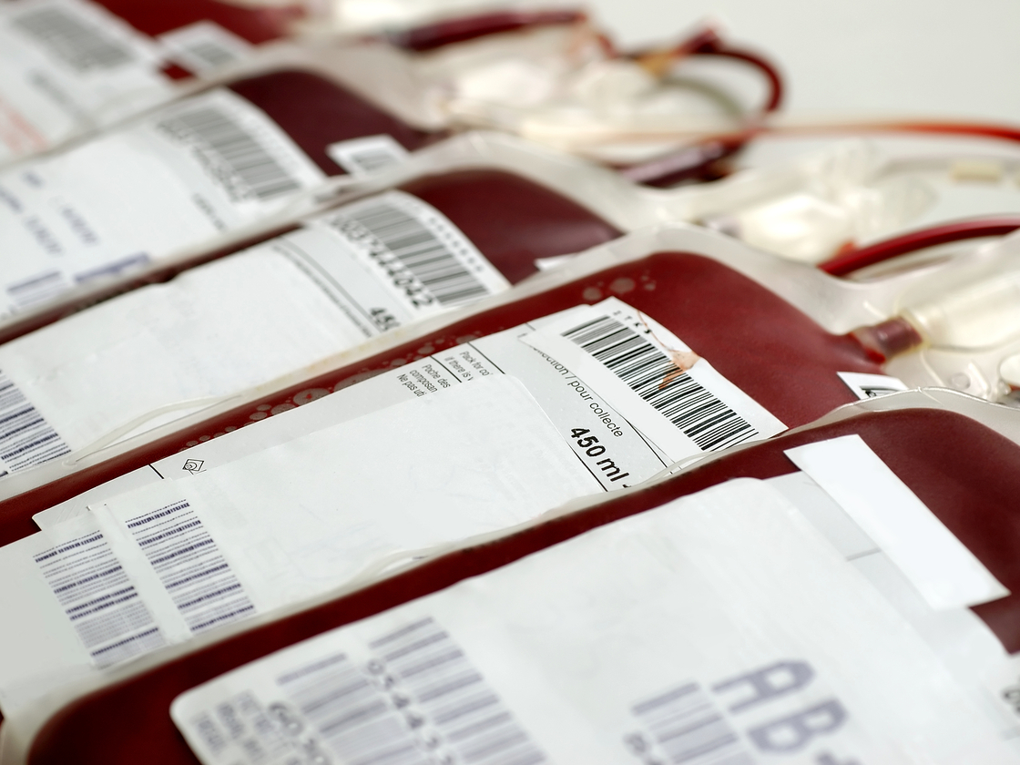 Hospitals began testing blood for hepatitis in 1992, so anyone who received a blood transfusion before then is at an increased risk for contracting the disease.