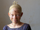 Zawia Kassim, 12, of Kigoma Region, would like to be a teacher someday. Zawia Kassim, 12, of Kigoma Region, would like to be a teacher someday.