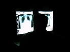 Who's there? A radiologist studies digital X-rays in a viewing room at what is now called the Walter Reed National Military Medical Center in Bethesda, Md. Who's there? A radiologist studies digital X-rays in a viewing room at what is now called the Walter Reed National Military Medical Center in Bethesda, Md.