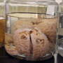Dr. Ann McKee, professor of neurology and pathology of Boston University School of Medicine and co-director of the Veterans Affairs Center for the Study of Traumatic Encephalopathy, inspects a brain in the Bedford Veteran Medical Center last year.