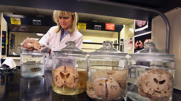 Dr. Ann McKee, professor of neurology and pathology of Boston University School of Medicine and co-director of the Veterans Affairs Center for the Study of Traumatic Encephalopathy, inspects a brain in the Bedford Veteran Medical Center last year.