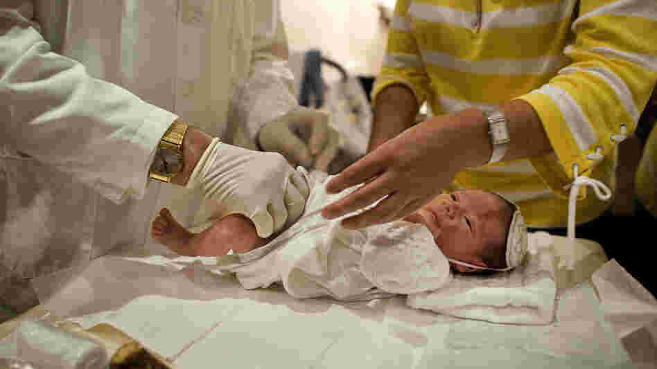 Rabbi A. Romi Cohn, a noted mohel, prepares an infant for circumcision at Congregation Shaare Zion in Brooklyn on Sept. 4. Cohn opposes a New York City rule requiring parental consent for a type of circumcision ritual practiced by some Orthodox Jews.