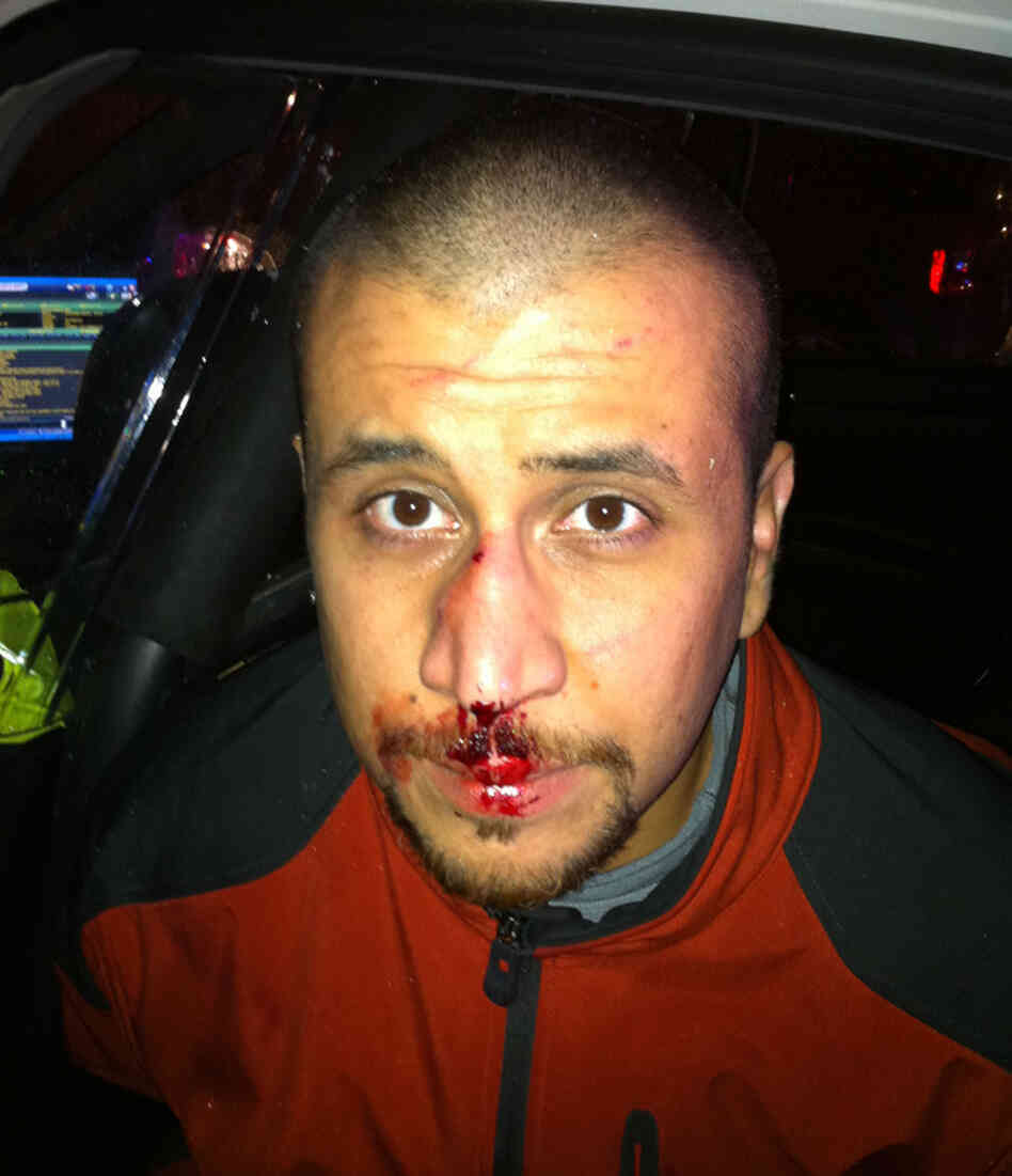 A photograph of George Zimmerman on the night he shot Trayvon Martin.