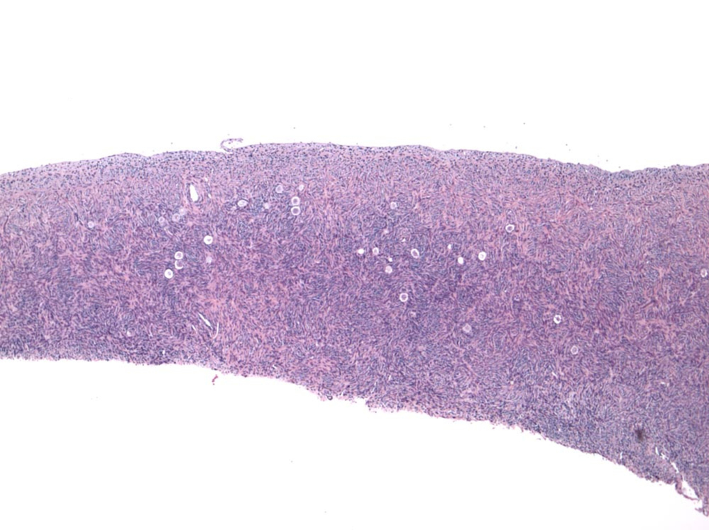 Doctors use tissue slides like this one of the ovary's outer cortex to confirm a woman's ovarian reserve. It's also the the ovary tissue that's removed in an ovarian transplant. Doctors use tissue slides like this one of the ovary's outer cortex to confirm a woman's ovarian reserve. It's also the the ovary tissue that's removed in an ovarian transplant.