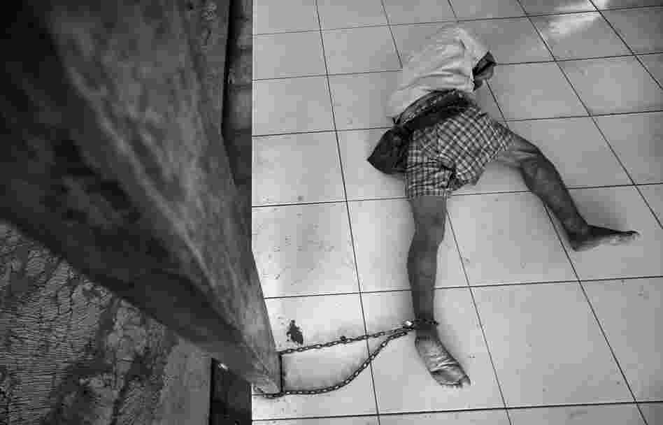 "Yayasan Galuh Rehabilitation Center is an impoverished mental health facility based in Bekasi, Indonesia, that hosts over 250 patients. Most come from poor families no longer interested in managing their condition, or are unable. Some patients are homeless, deposited after being taken off streets by police. ... Over one-third of the patients are shackled in chains."
