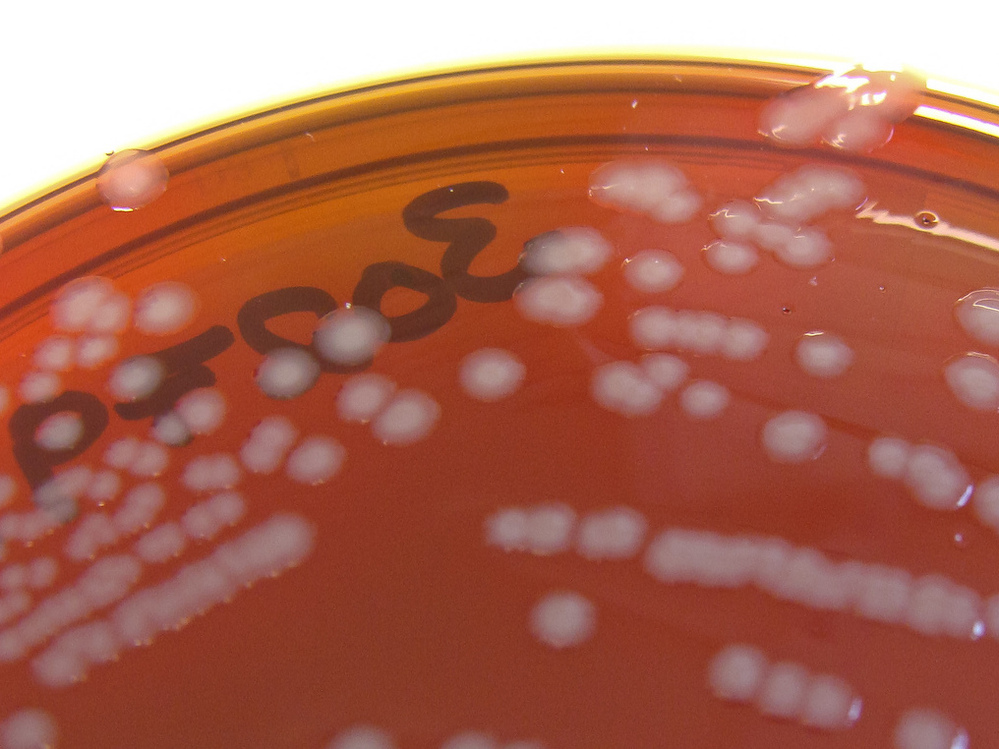 Neisseria gonorrhoeae, the bacteria that causes gonorrhea, quickly develops resistance to each antibiotic we throw at it. Neisseria gonorrhoeae, the bacteria that causes gonorrhea, quickly develops resistance to each antibiotic we throw at it.