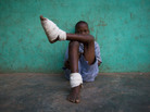 A boy with multiple Guinea worms sits outside a containment center in northern Ghana, February 2007. A boy with multiple Guinea worms sits outside a containment center in northern Ghana, February 2007.