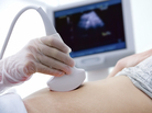 A woman gets a sonogram A woman gets a sonogram