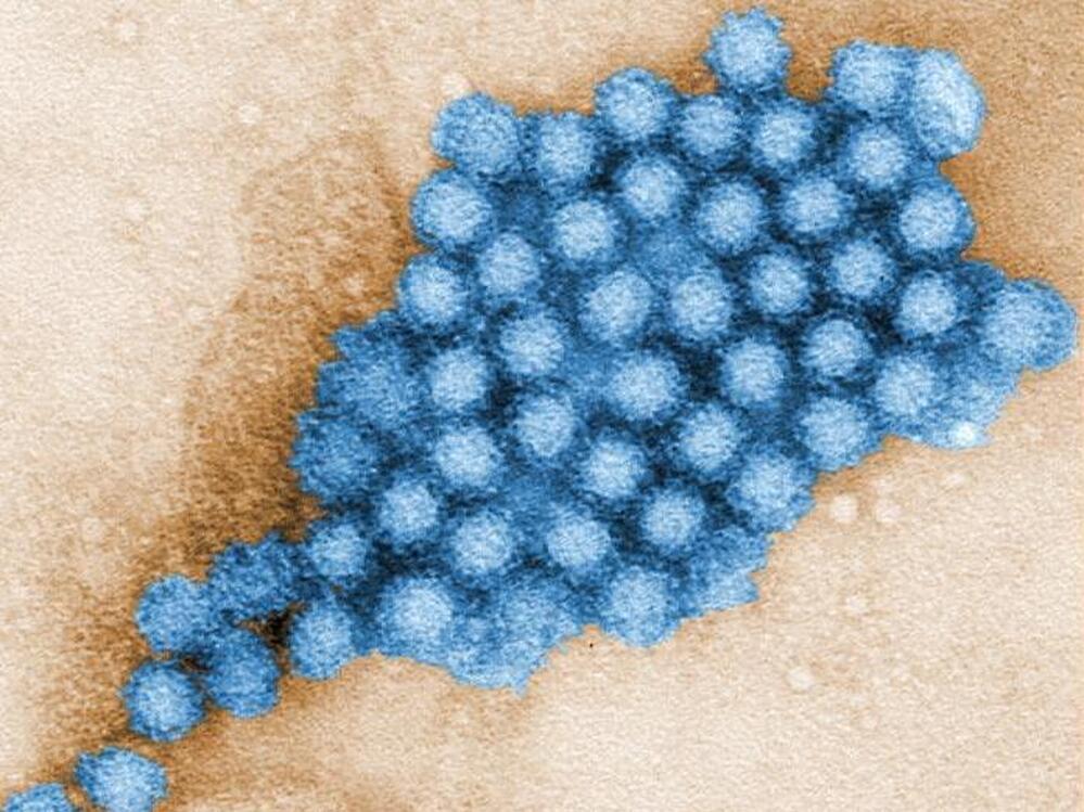 This cluster contains enough norovirus particles to make you sick.