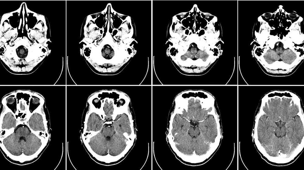 Doctors' use of CT head scans for hospitalized patients didn't change when the prices were revealed at the time an order was being made.